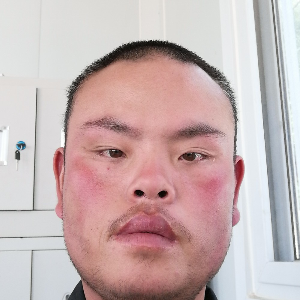 凉城饱满的照片