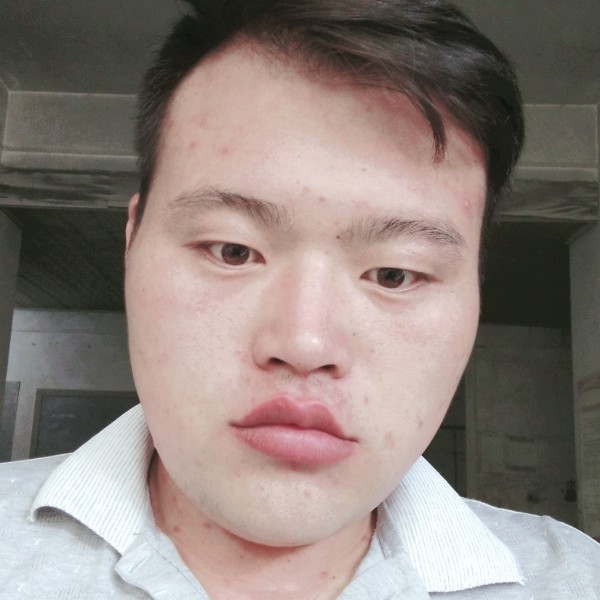 无可取代的笑受伤的照片