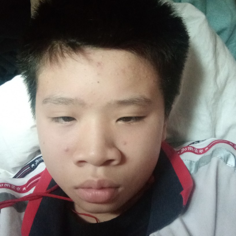 阑尾炎的照片