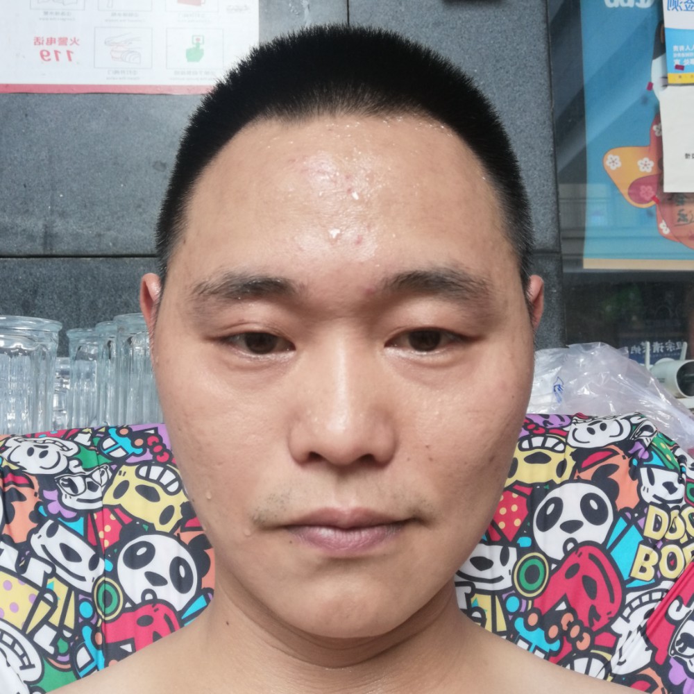 川疙瘩的照片