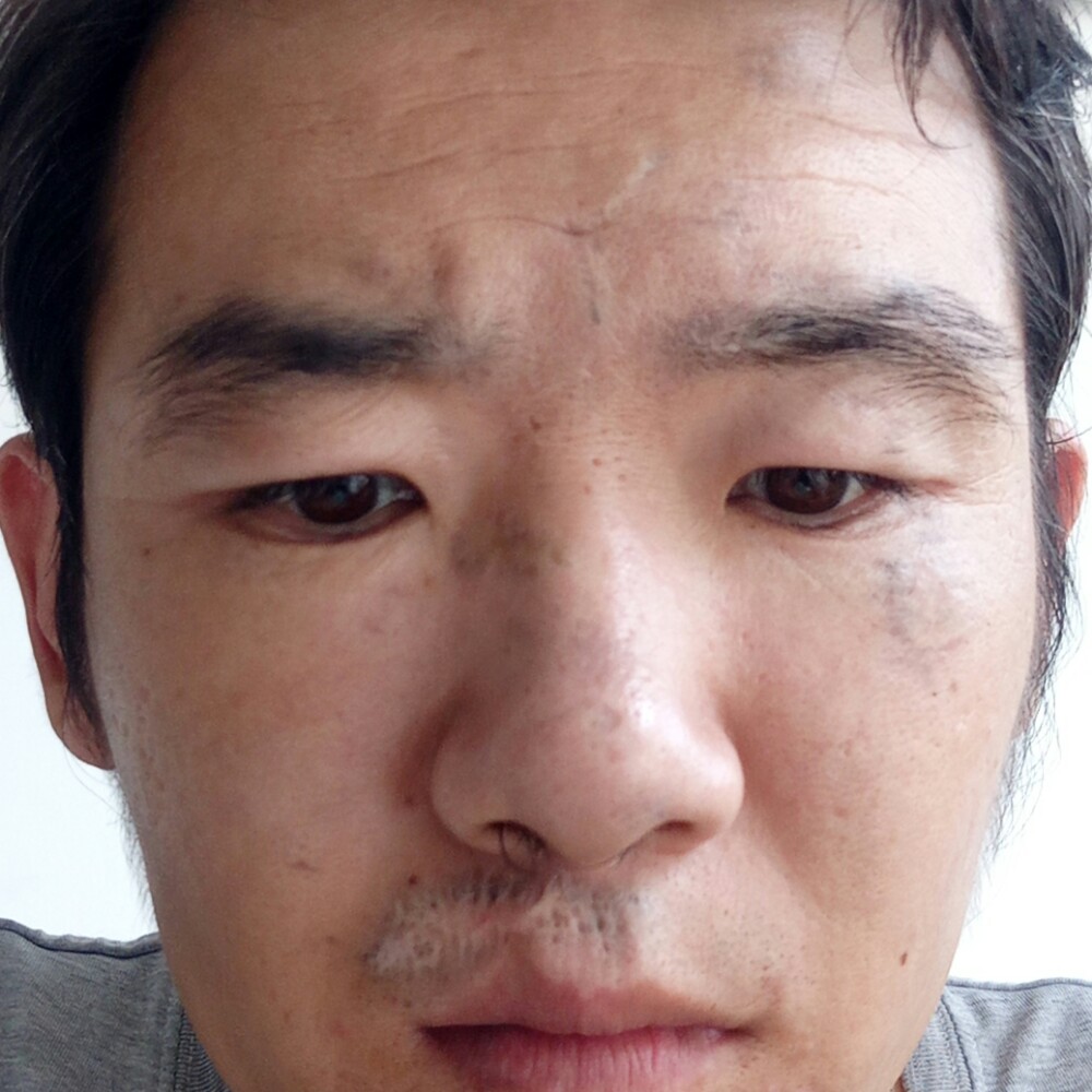 风中迎薯片的照片