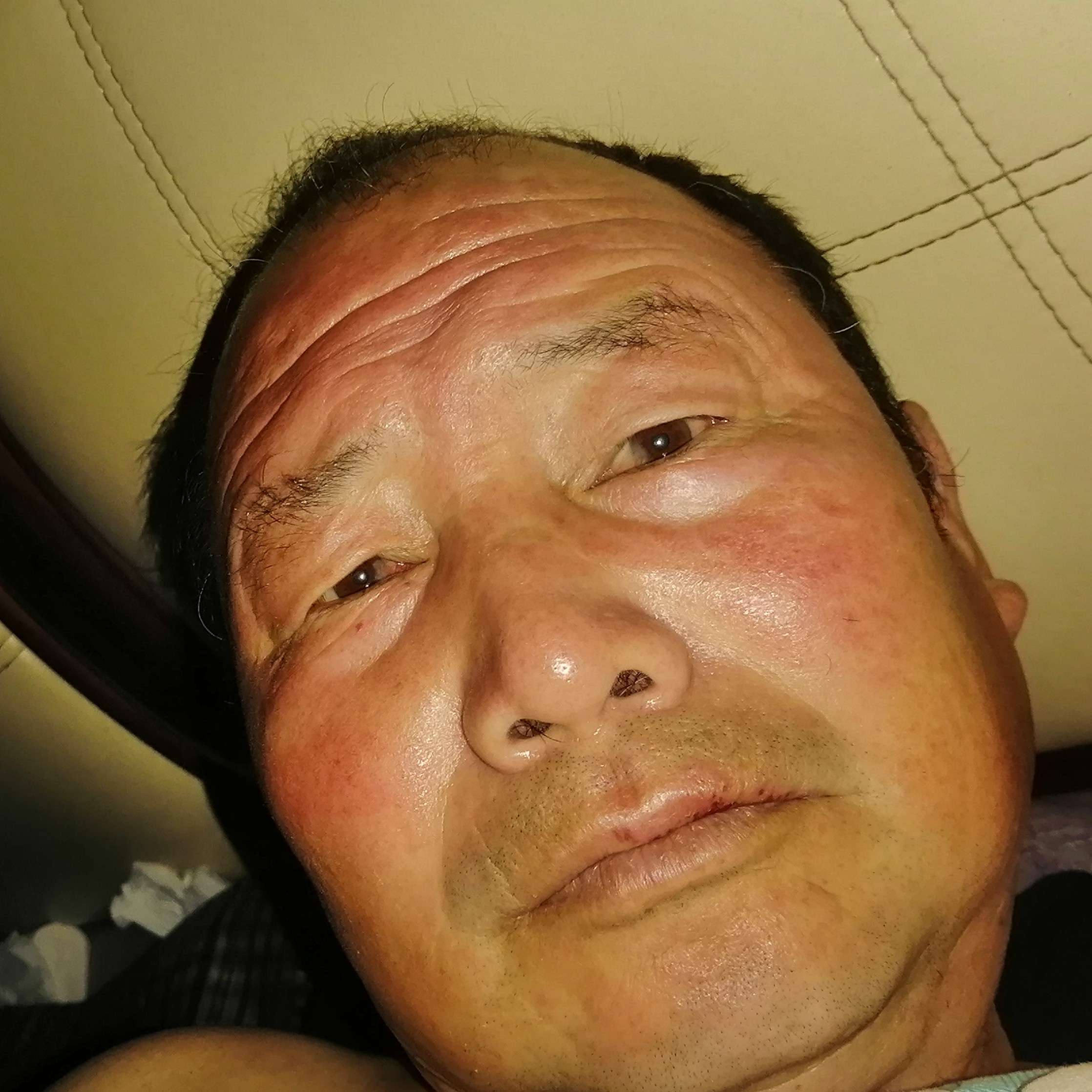 粗心蹙眉含羞草的照片