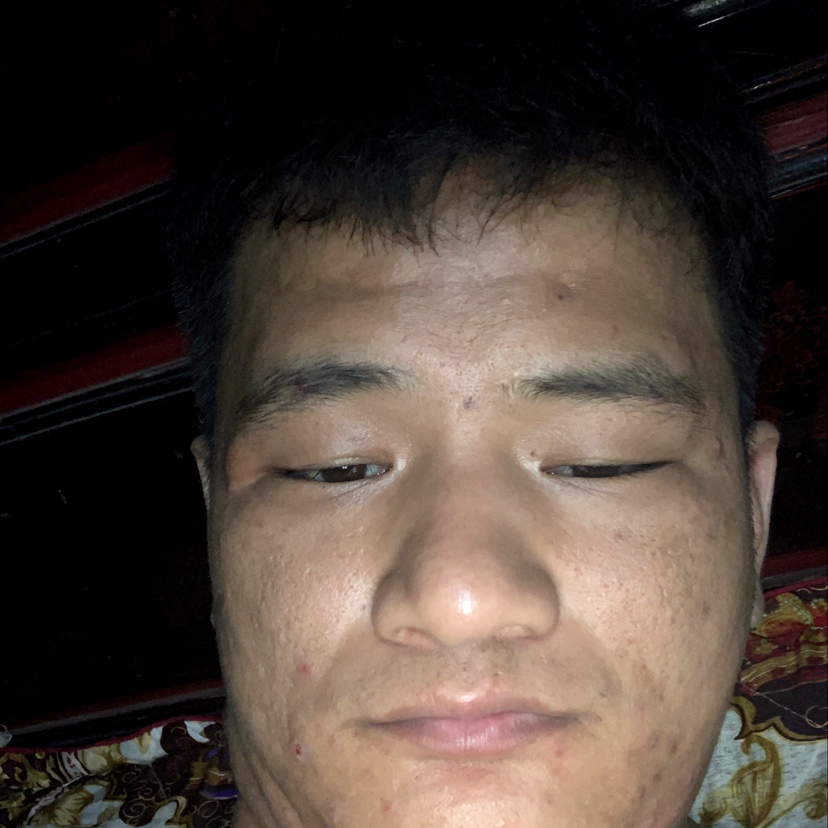 雨相许愤怒的照片