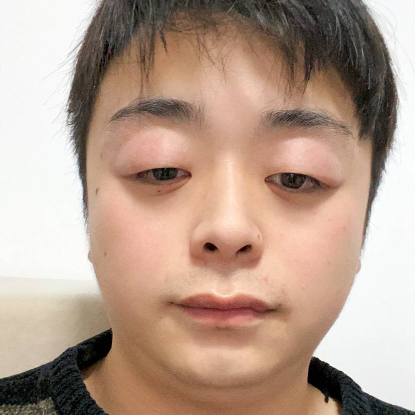 谁多么刺猬的照片