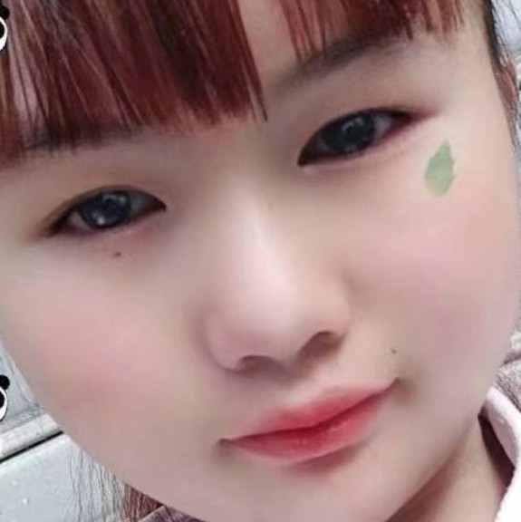 爱笑深拥泥猴桃的照片