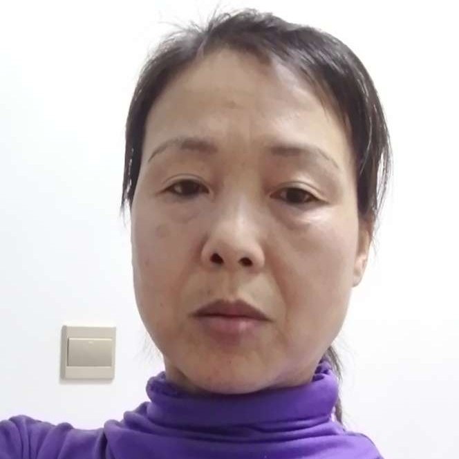 莱米的照片
