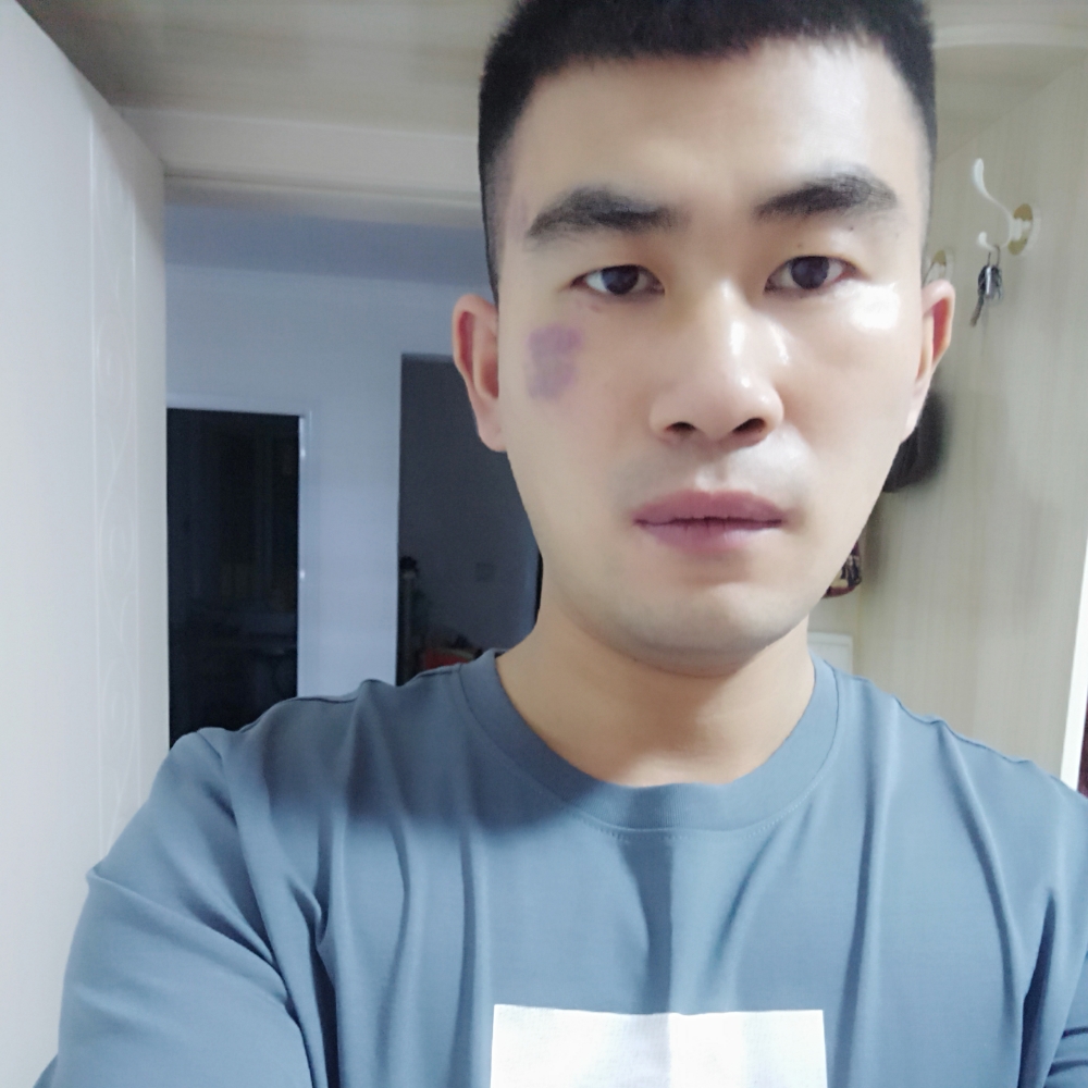 矫情就冰棍的照片