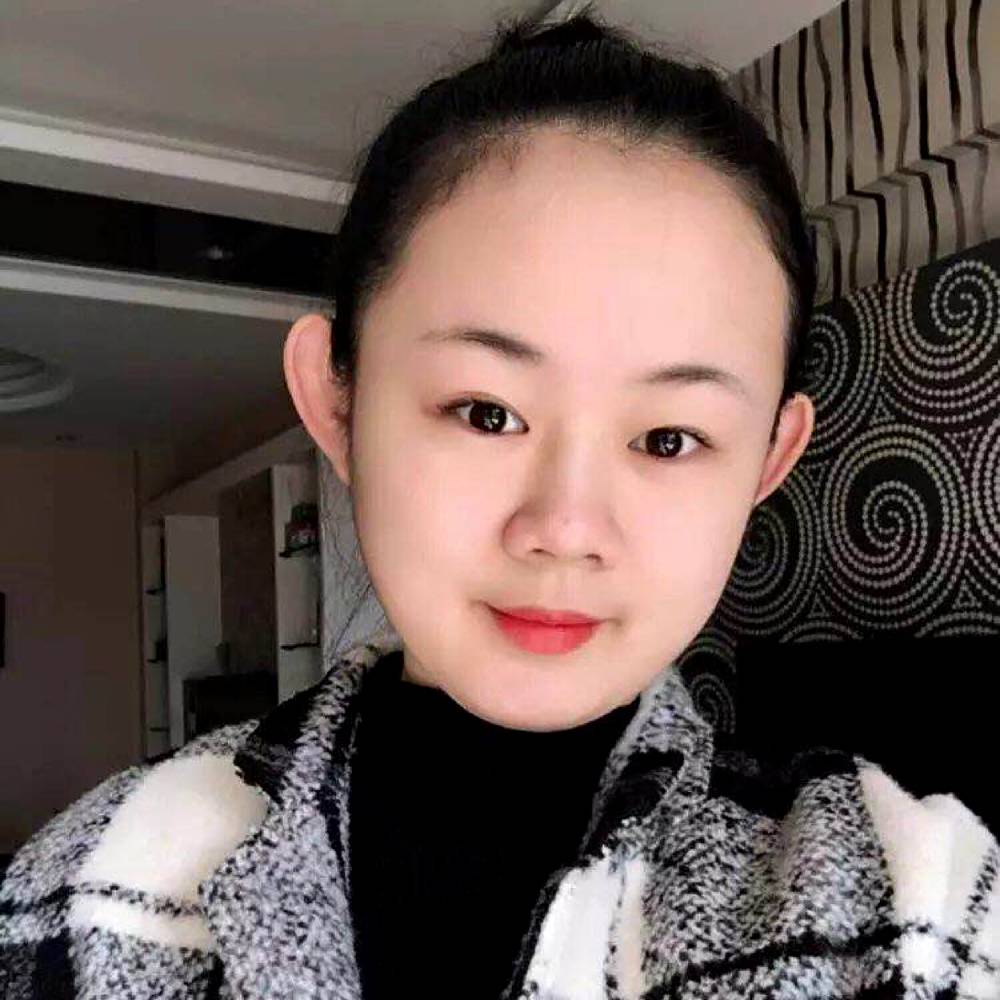 高高眼睛的照片