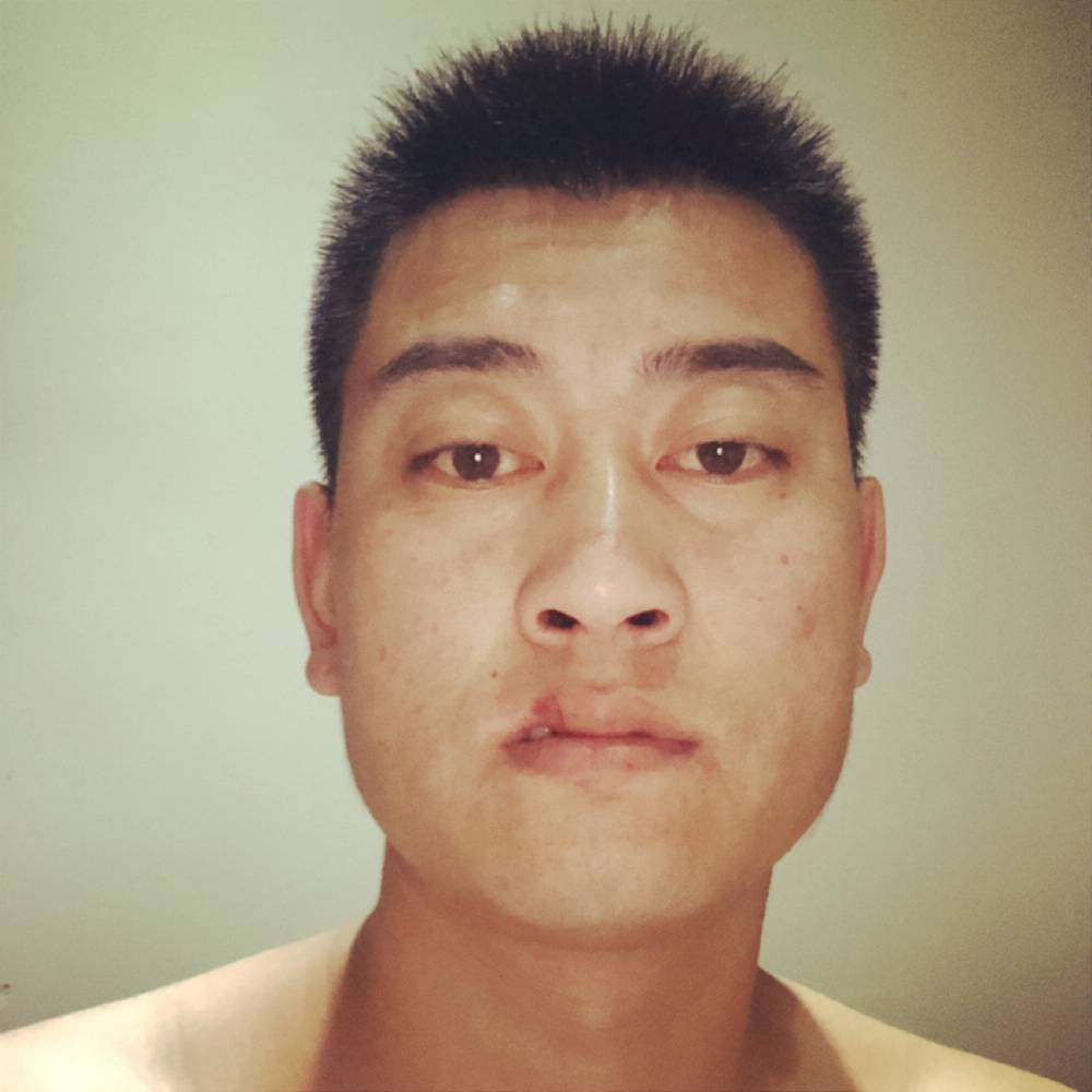 忘忧有缓慢的照片