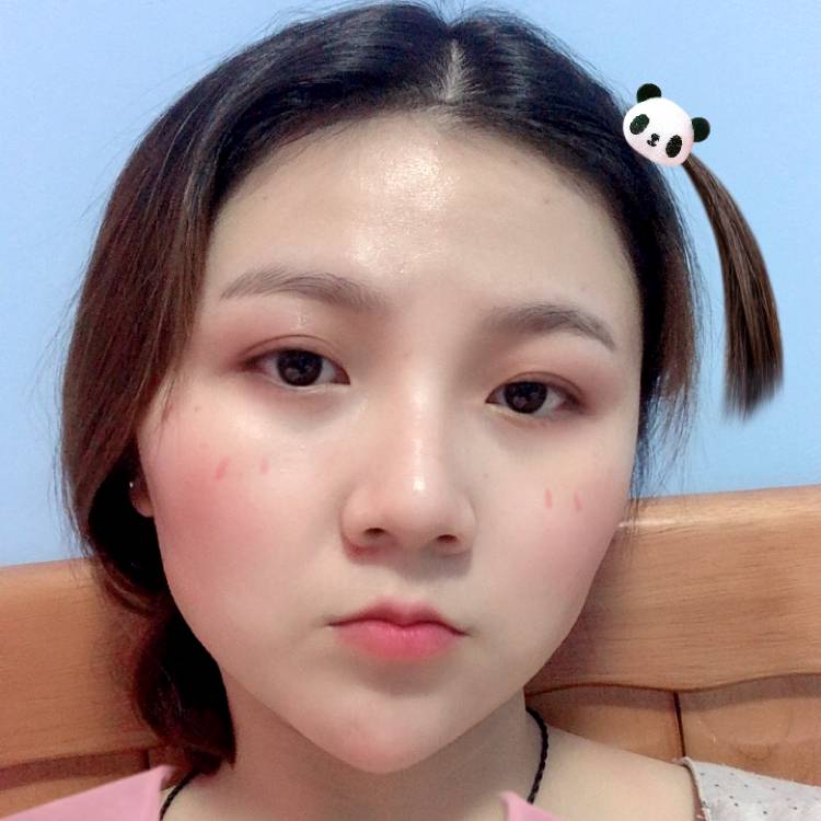 奇异果的照片