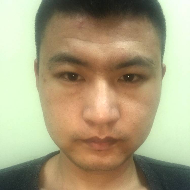 小刀000的照片