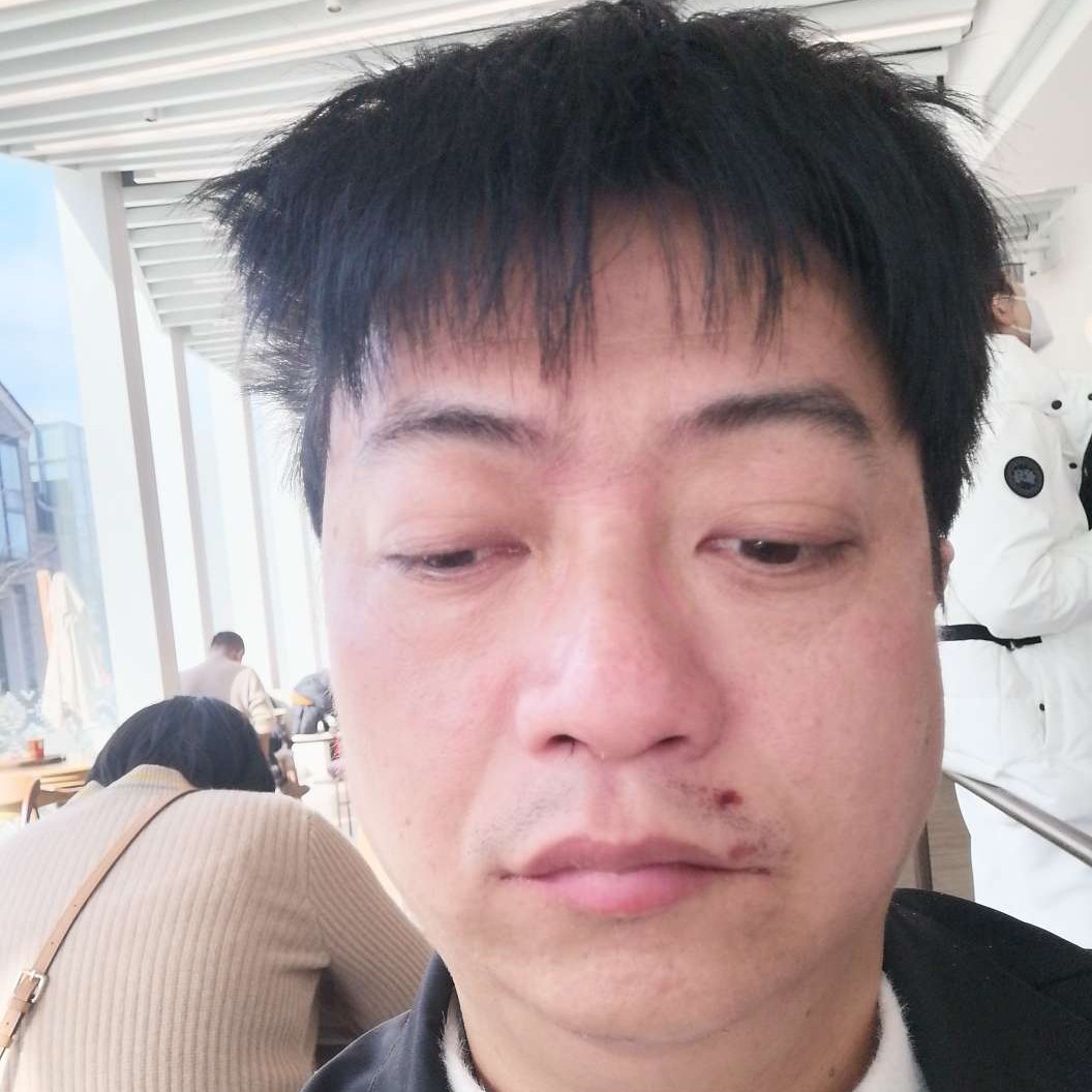 哈密瓜苦恋害羞的照片