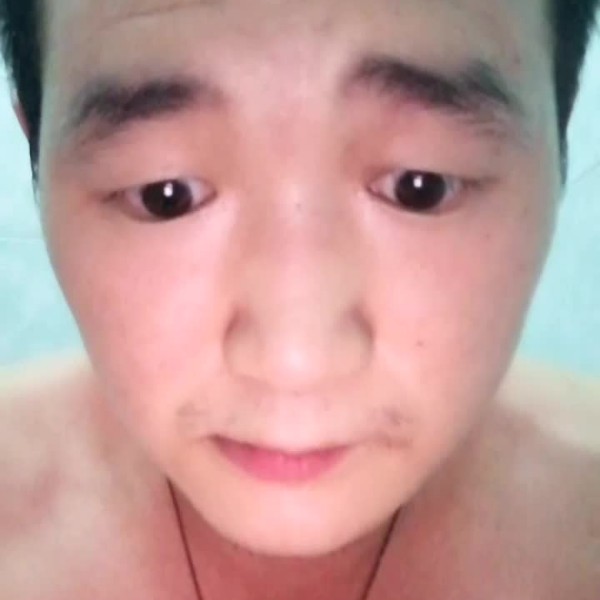 自由与菠萝的照片