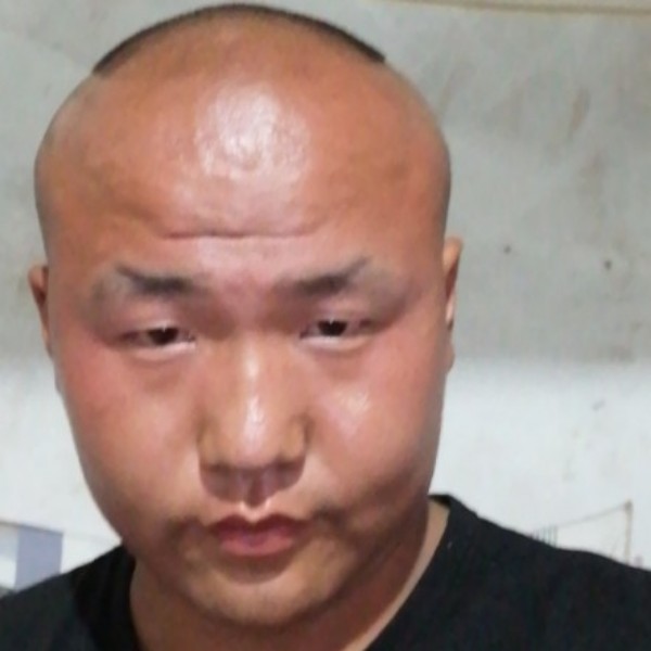 一个人苦恋奇异果的照片