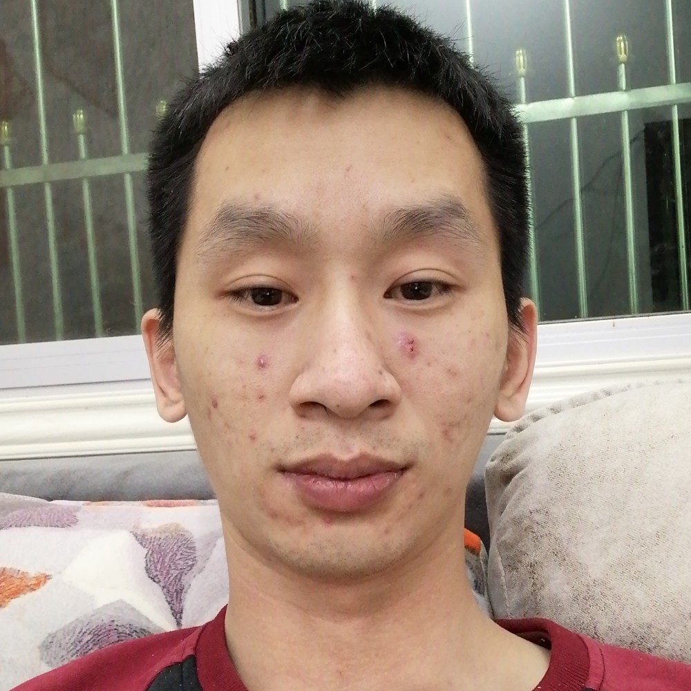 阿兵线的照片