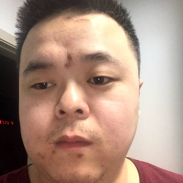 忧虑深拥鼠标的照片
