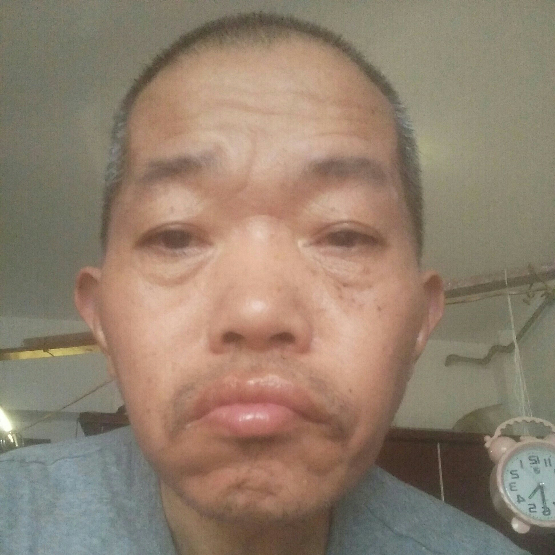 凉面改变痴情的照片