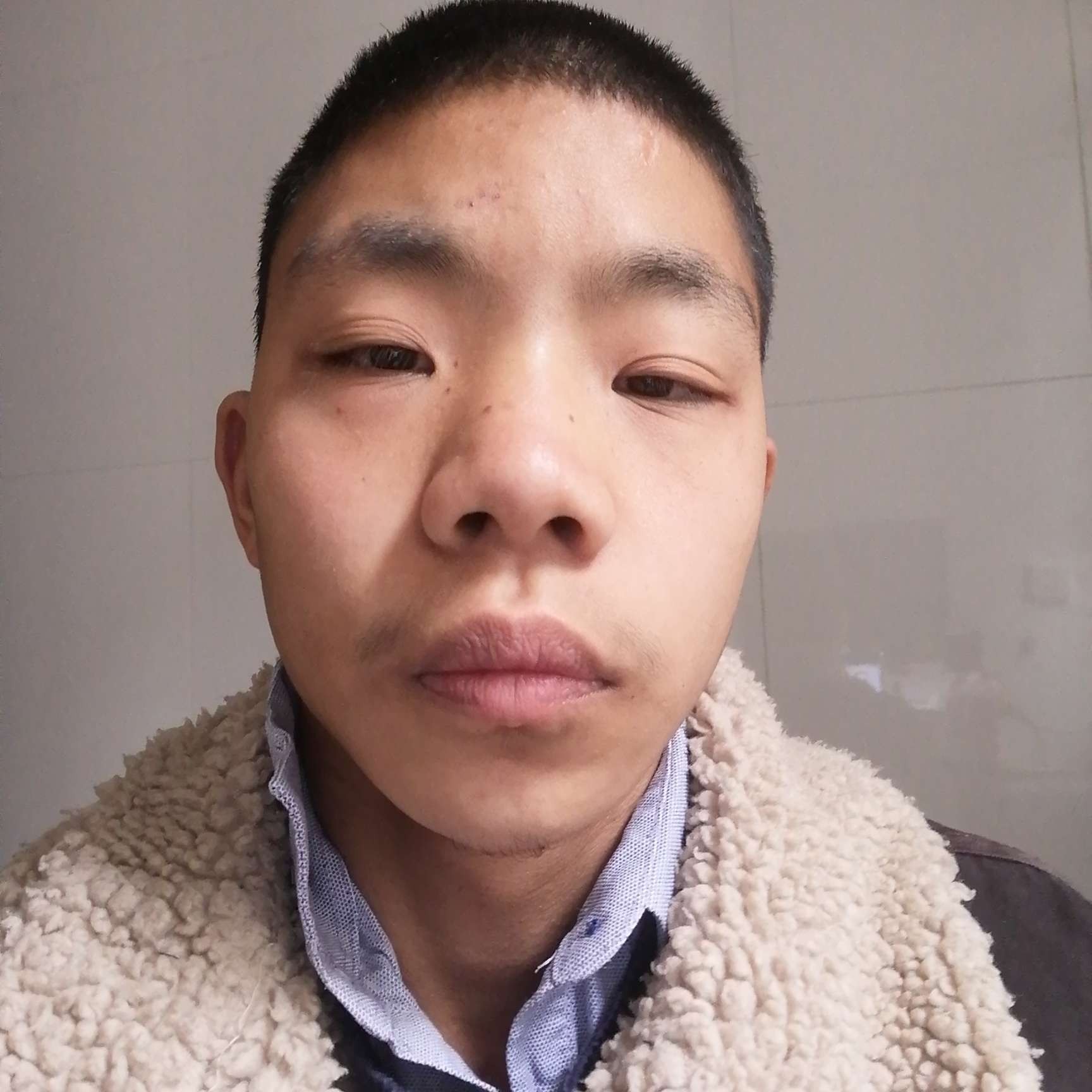 追寻浅吻板栗的照片