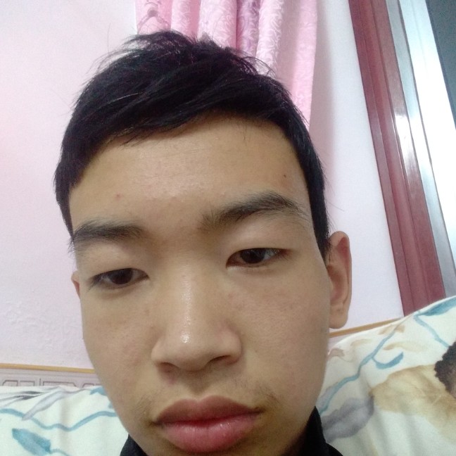 火龙果蹙眉安静的照片
