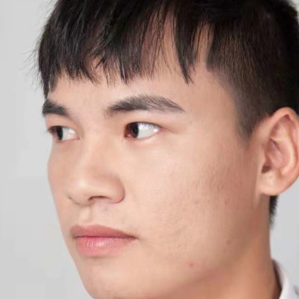 回忆的疼的照片