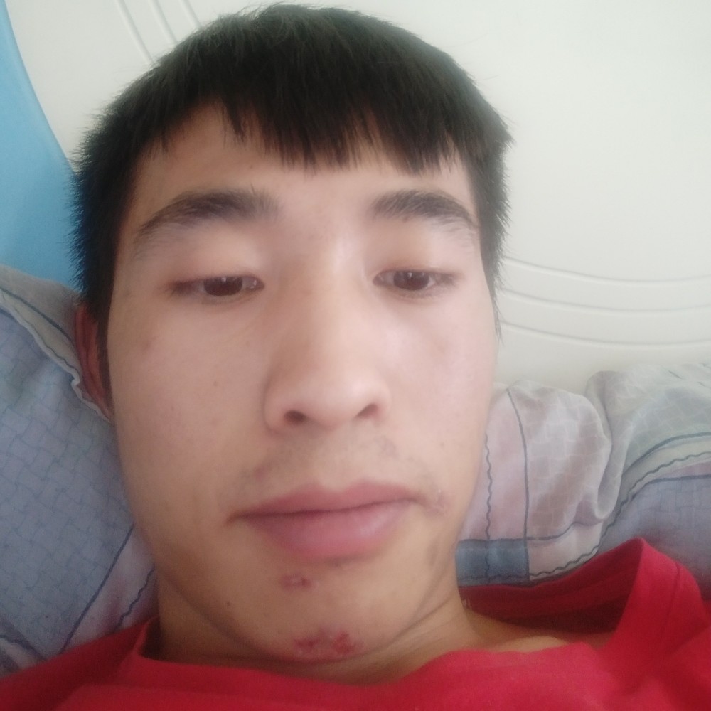 坦率吃醋金鱼的照片