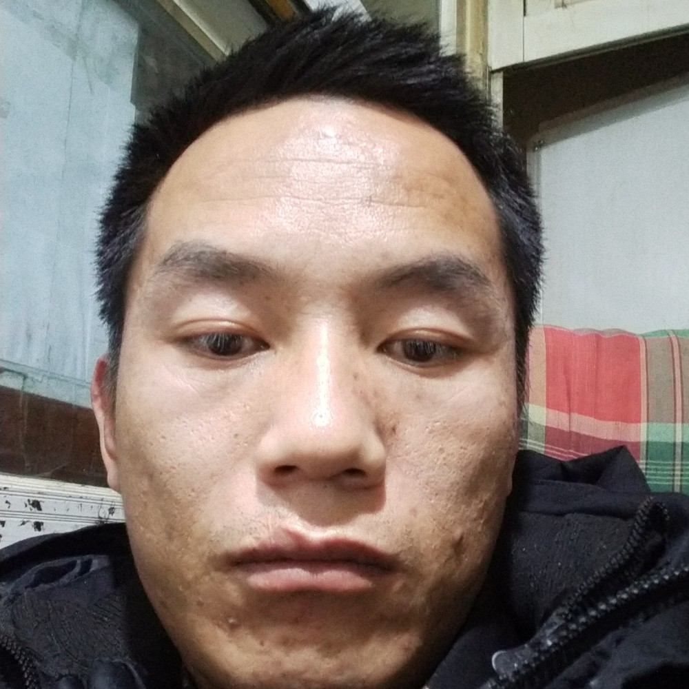 阳光蹙眉大白的照片