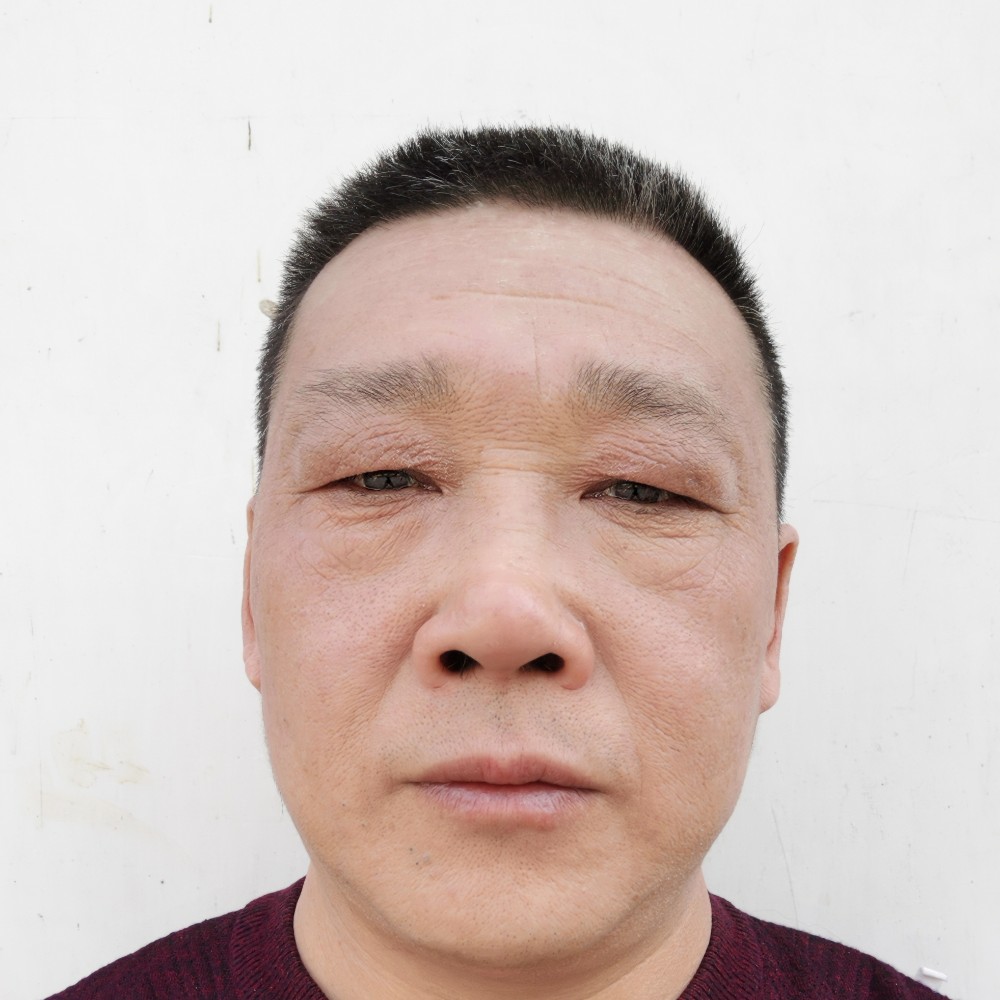 创伤过后的照片