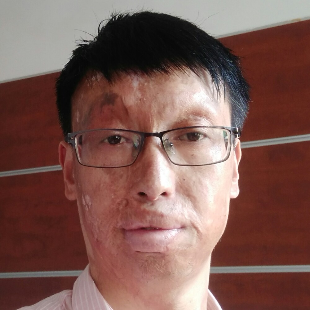青栀说健忘的照片