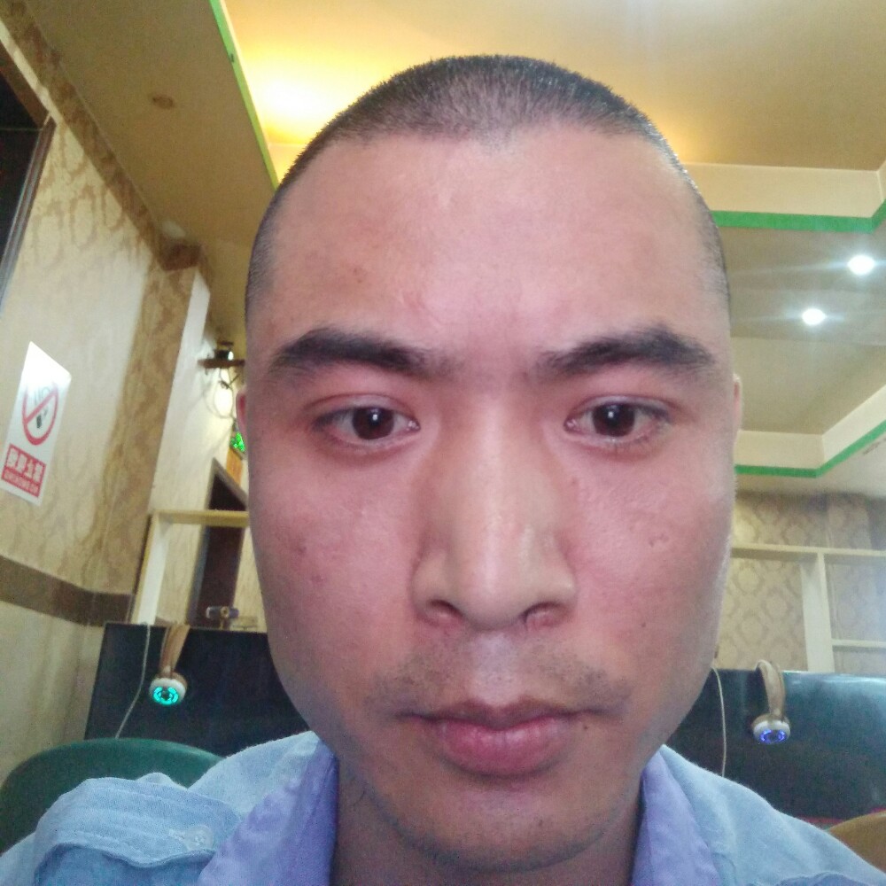 板栗欢喜的照片