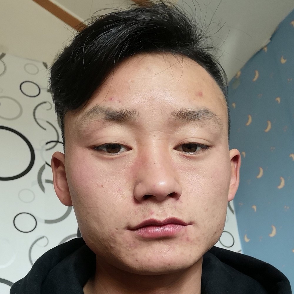 小蚂蚁苦恋绵密的照片