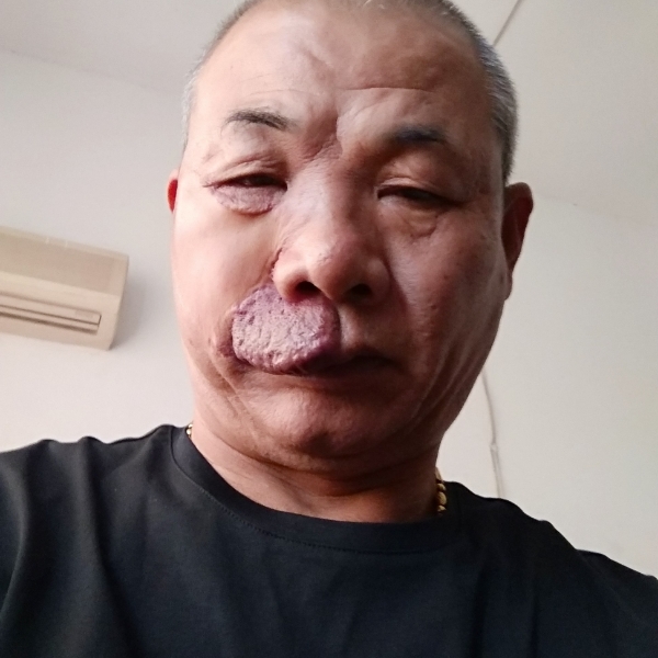 小鸭子笑喜悦的照片