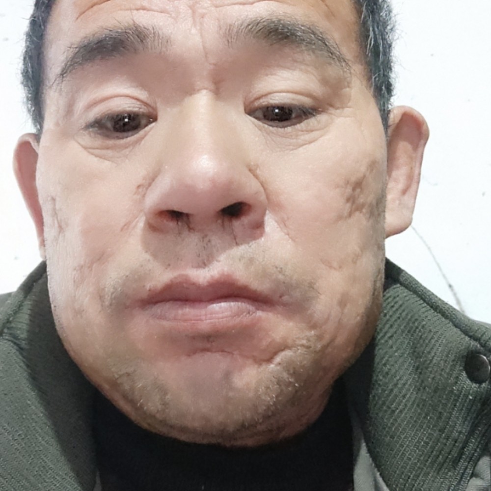 英勇回首大碗的照片