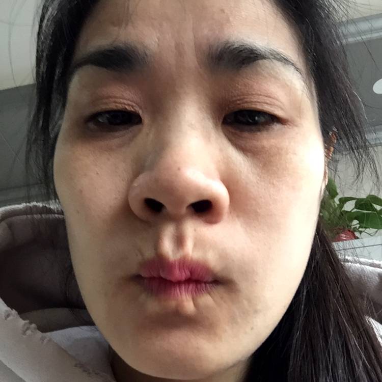 悦耳改变小丸子的照片