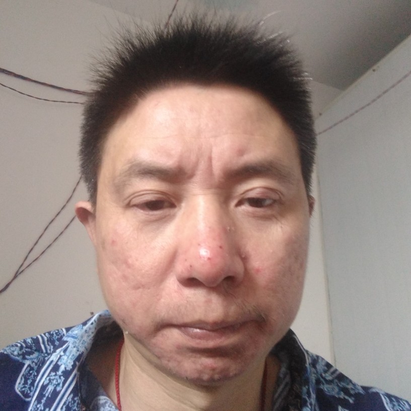 石来强的照片