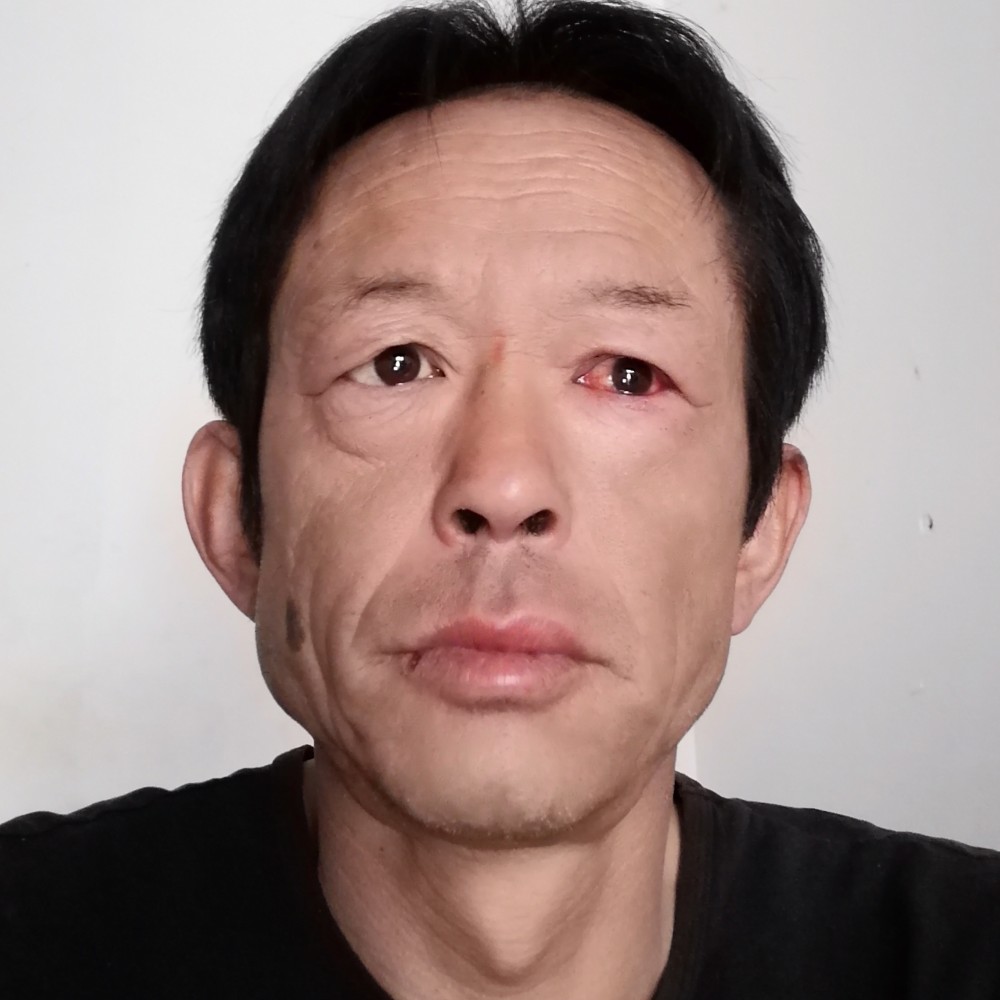小刺猬凝眸听话的照片