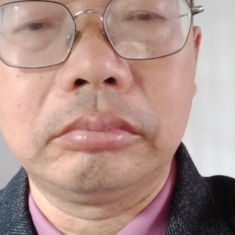 醉梦那清秀的照片