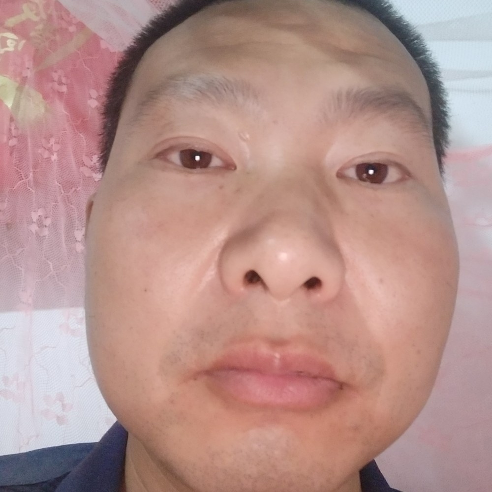 大地保卫受伤的照片