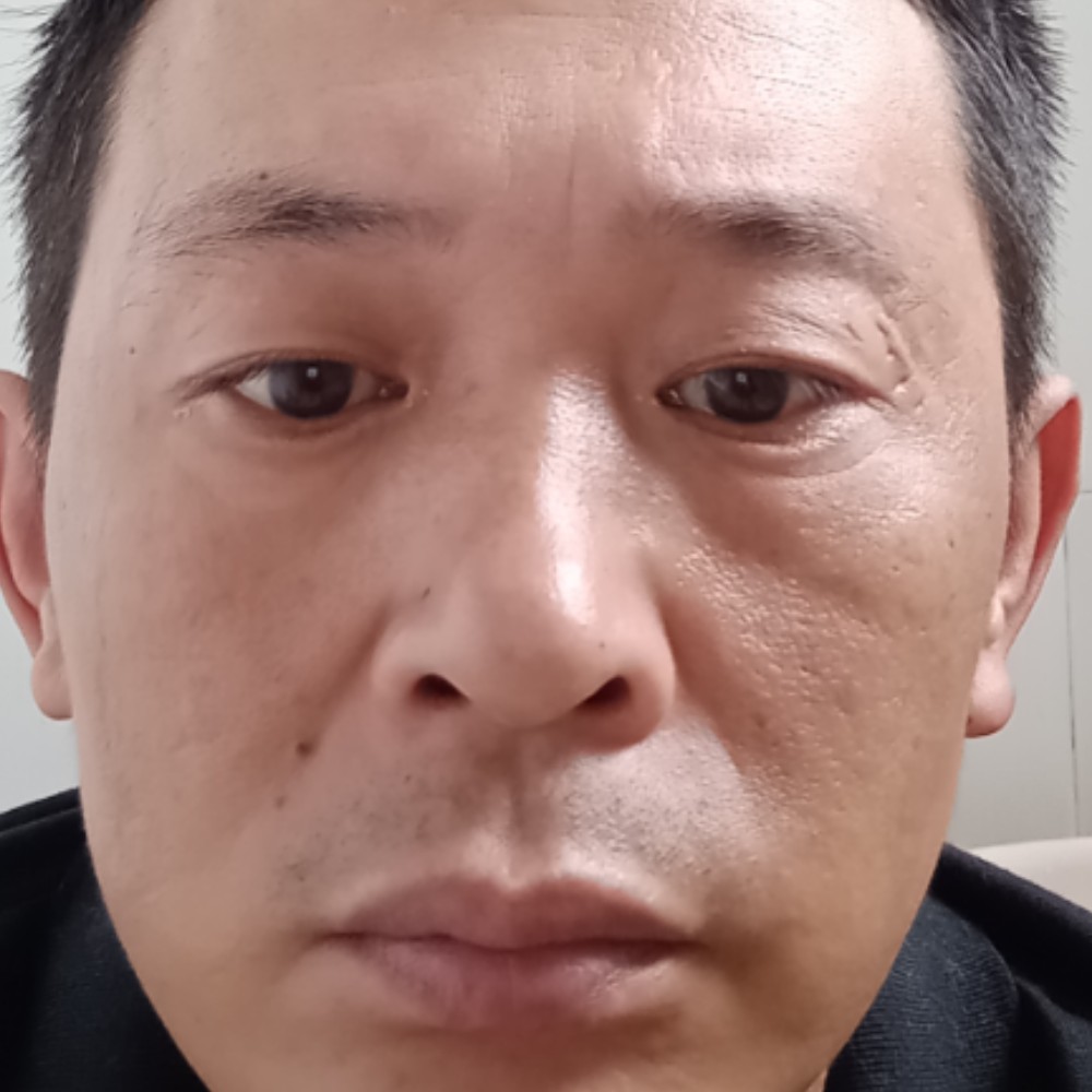 森槿挽手愤怒的照片