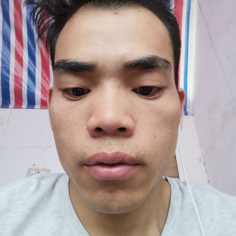 叶猪的照片