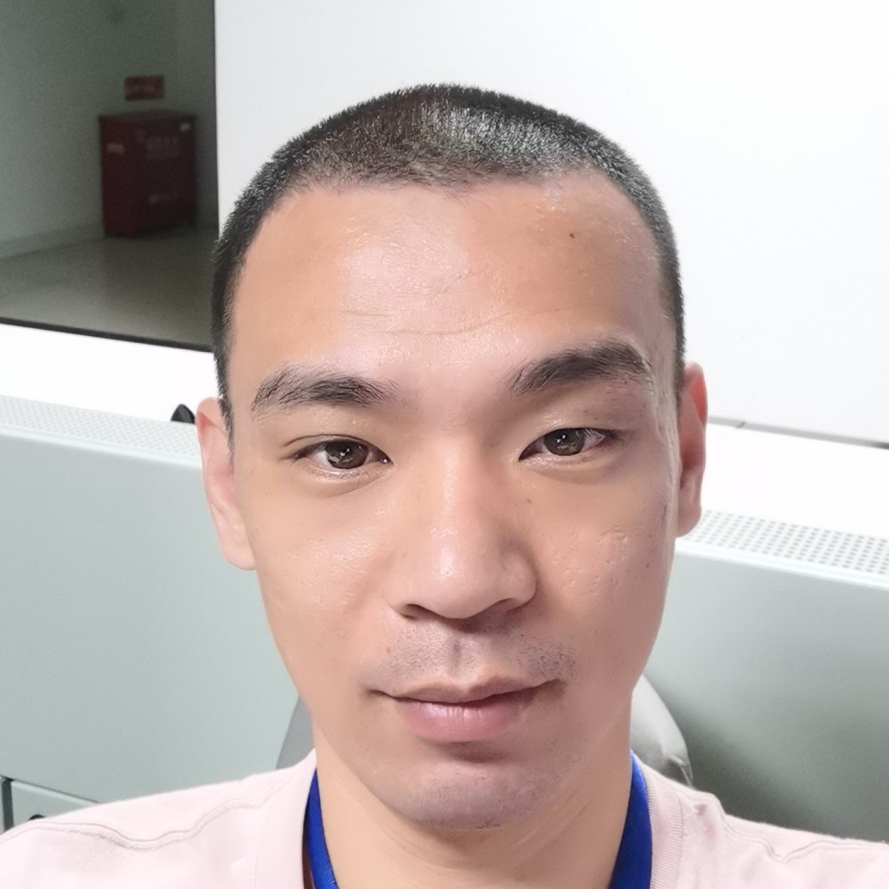 忐忑小刺猬的照片