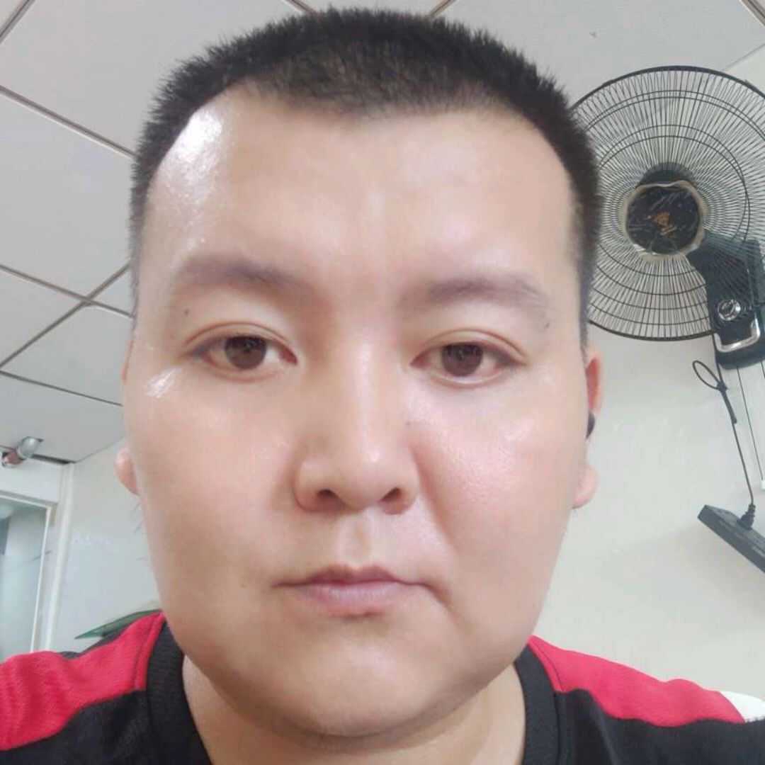 眼睛方老迟到的照片