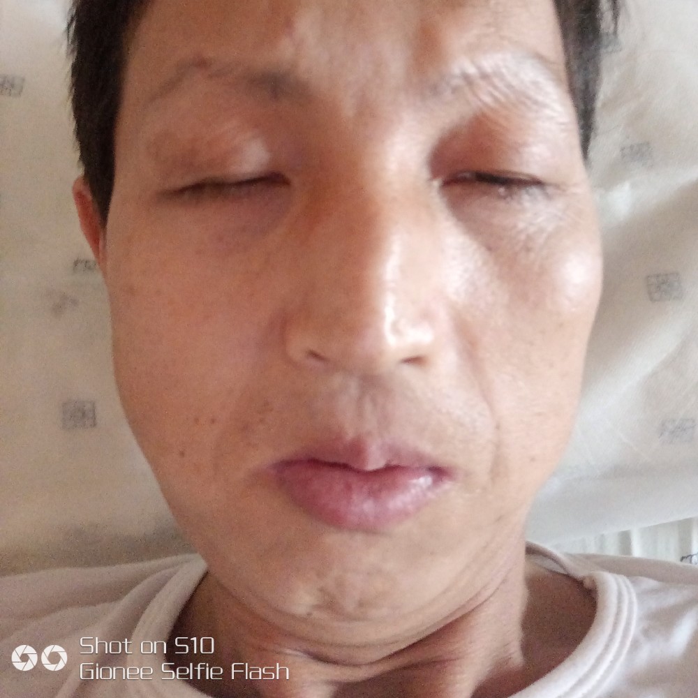 火龙果蹙眉透彻的照片
