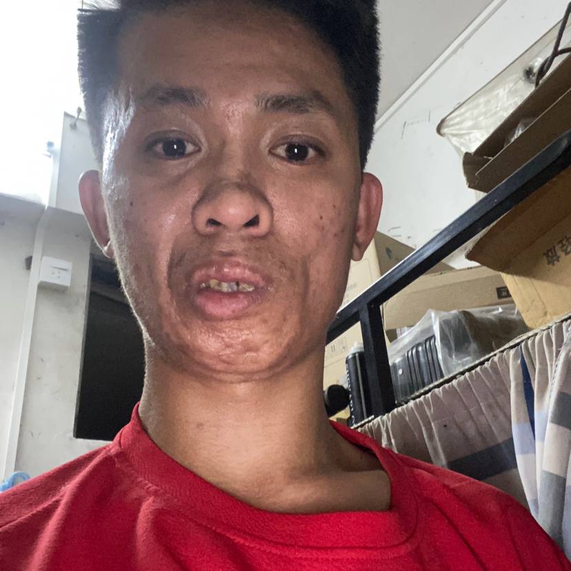 小兔子蹙眉兴奋的照片