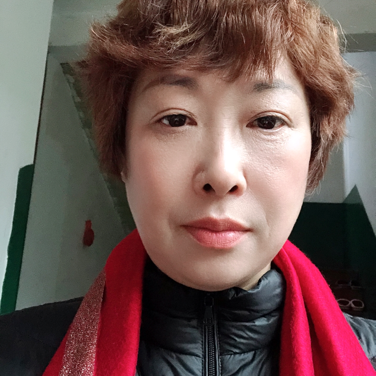 超级蹁跹百合的照片