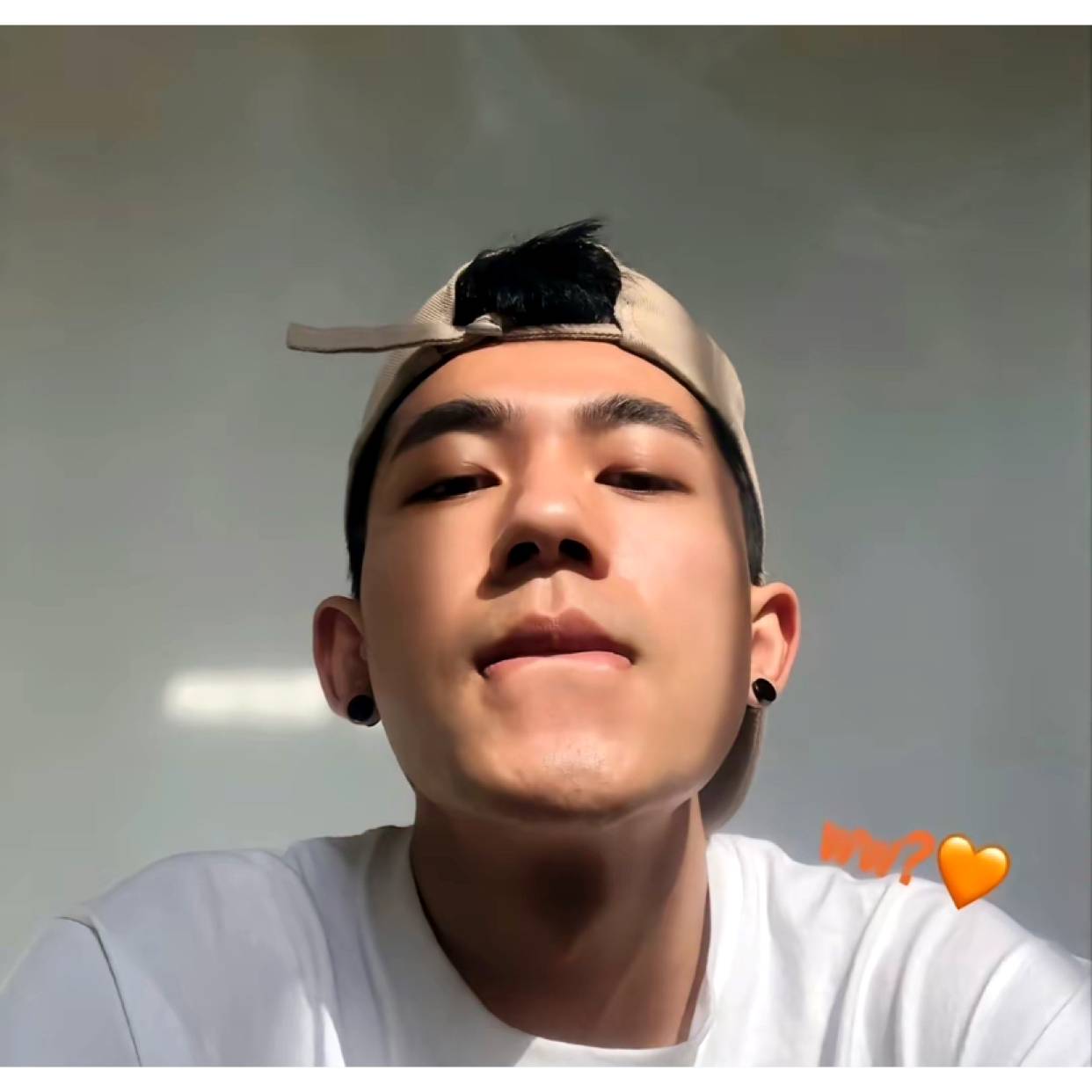 V细胞的照片