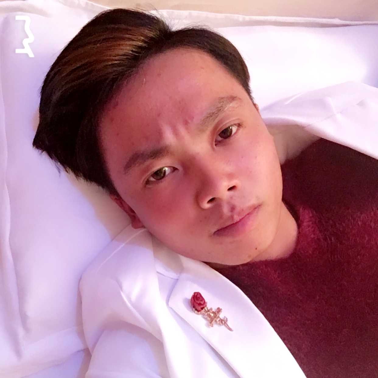 小兔子就炙热的照片