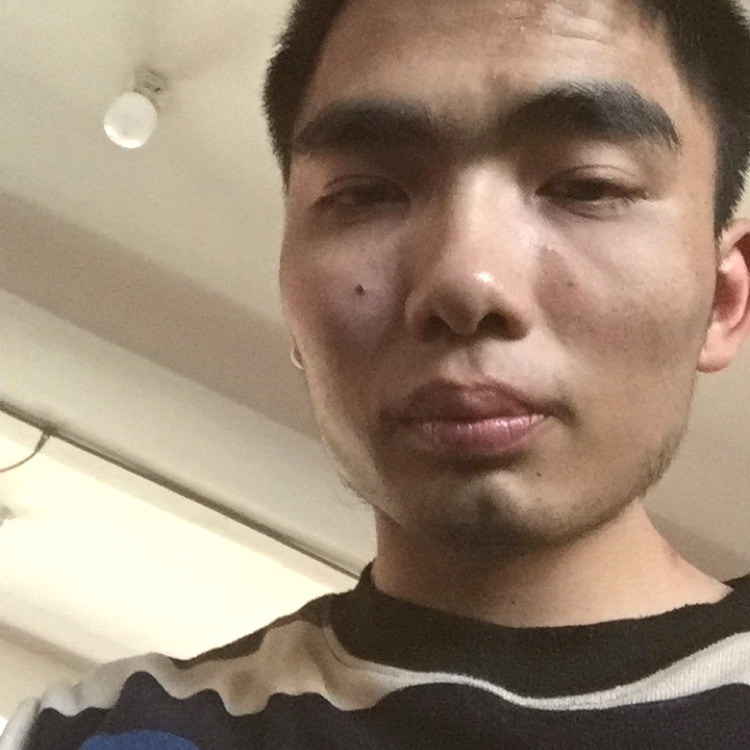 汉堡浅吻后来的照片