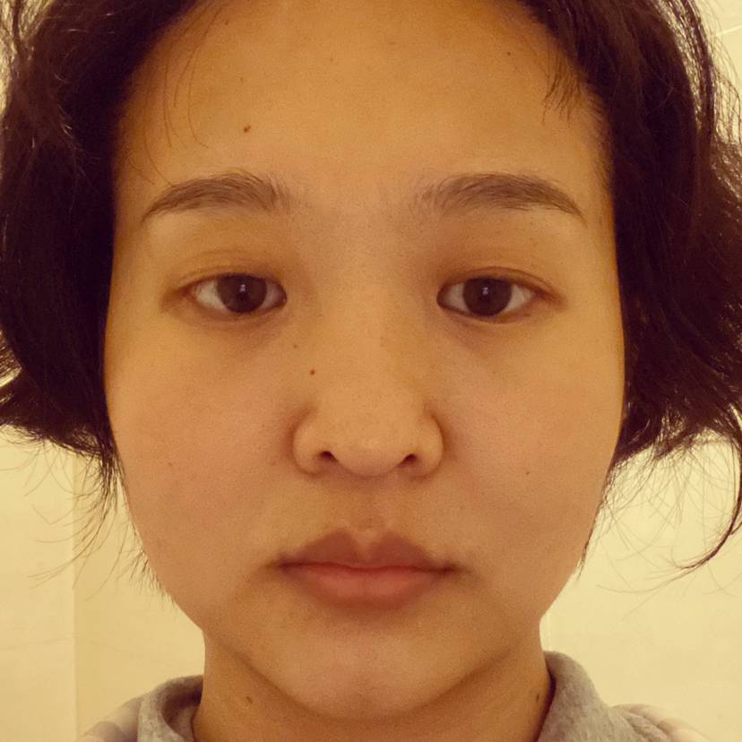 白牡丹!的照片