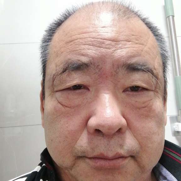 现实手套，的照片