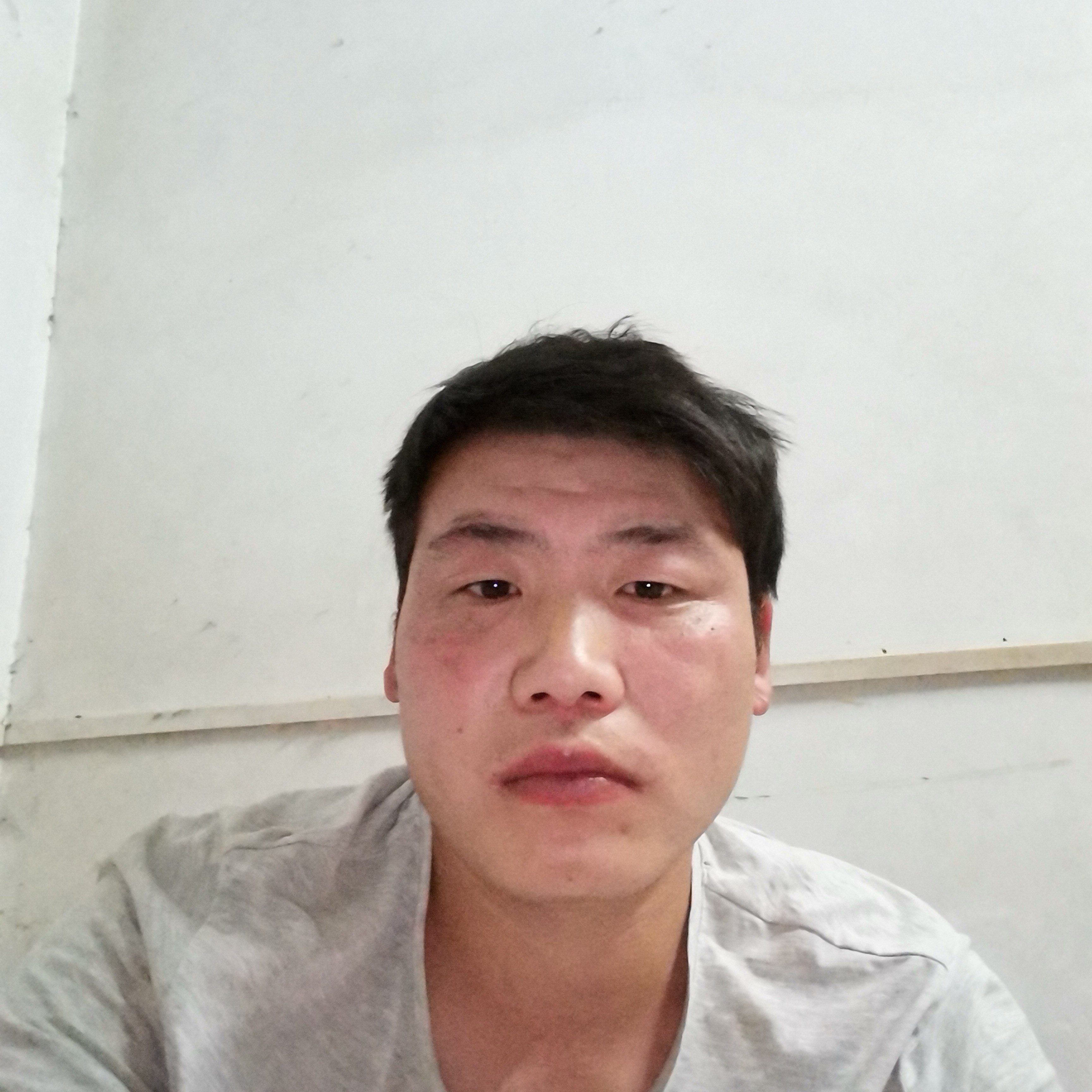 畅快扯眼睛的照片